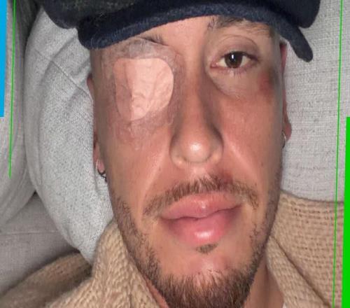 早日康復，阿根廷前國腳奧坎波斯左臉面癱，已在接受治療