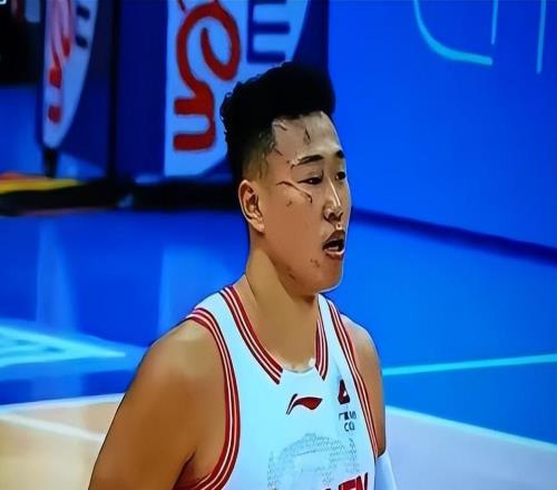 CBA真硬漢！臉部受傷眼都腫了還在場上拼，媒體和球迷：令人敬佩