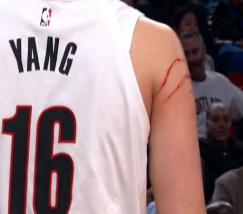 創NBA生涯紀錄！楊瀚森連7戰登場入輪轉被抓出兩道血痕引爭議