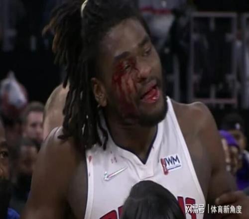 爆，無(wú)限期禁賽，血濺三尺+替補(bǔ)席爆燃，果真是血抗老詹的人