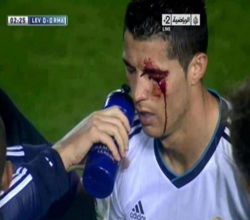 我無心肘擊C羅卻被媒體差點送進監獄的故事_西甲直播